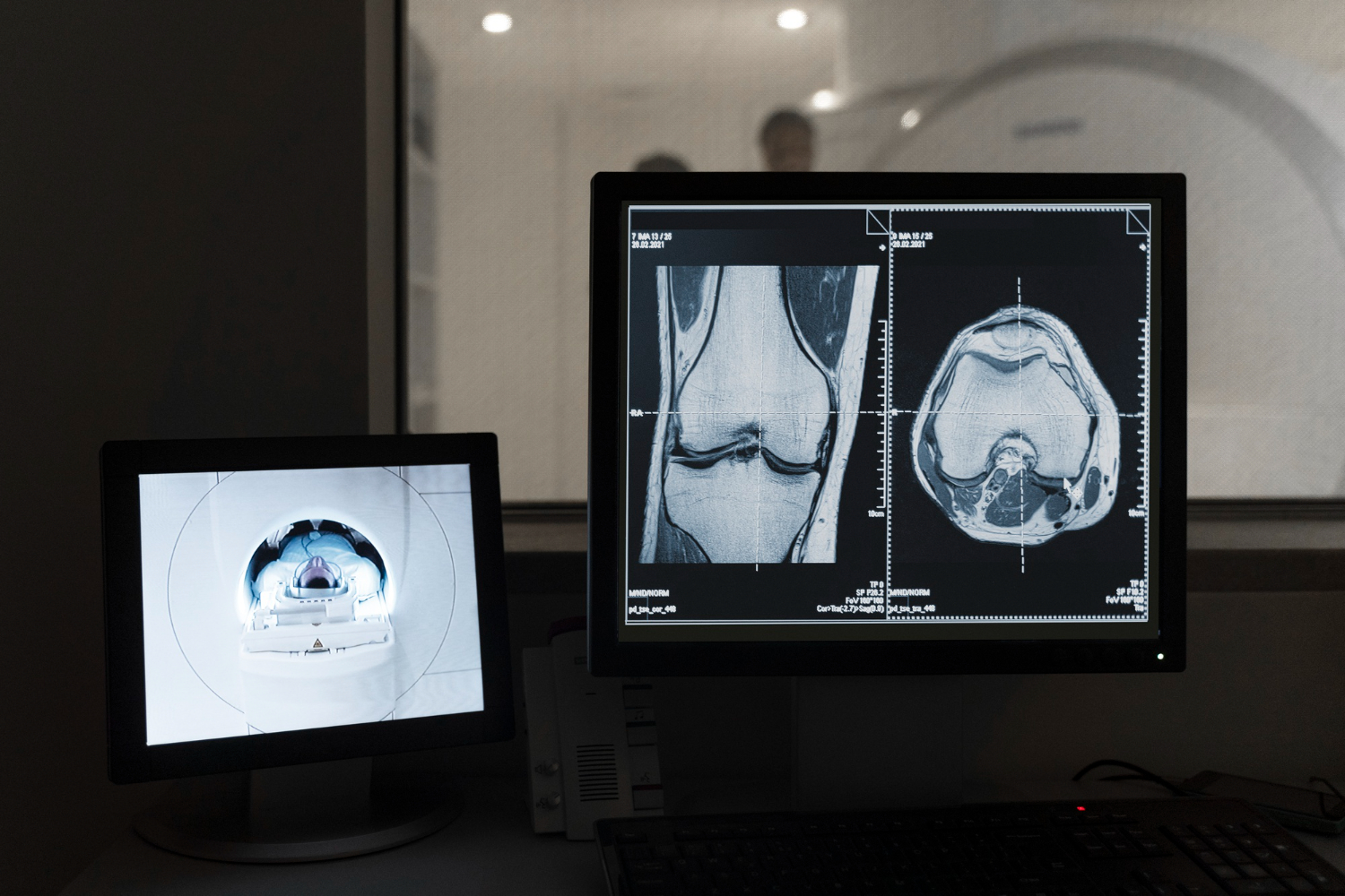 Algoritmos de IA otimizam a manutenção de aparelhos médicos Algoritmos de IA otimizam a manutenção de aparelhos médicos