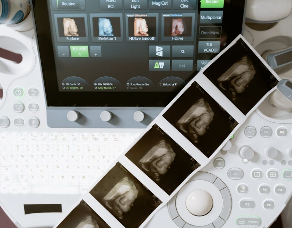 Algoritmos que monitoram a saúde no pré-natal: como funcionam? Free stock photo of 3d scanning, 3d ultrasound, anatomy